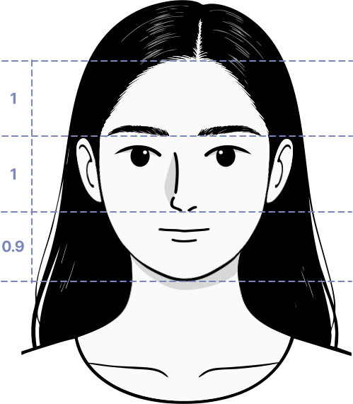여성모발이식3_1
