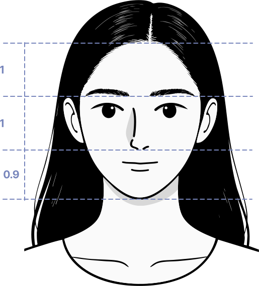 여성모발이식3_2