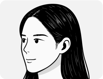 여성모발이식4_2