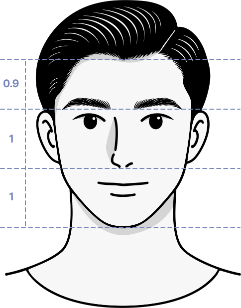 남성모발이식2_2